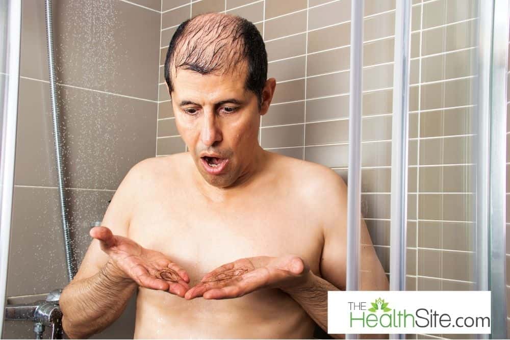 Covid Hairfall Treatment